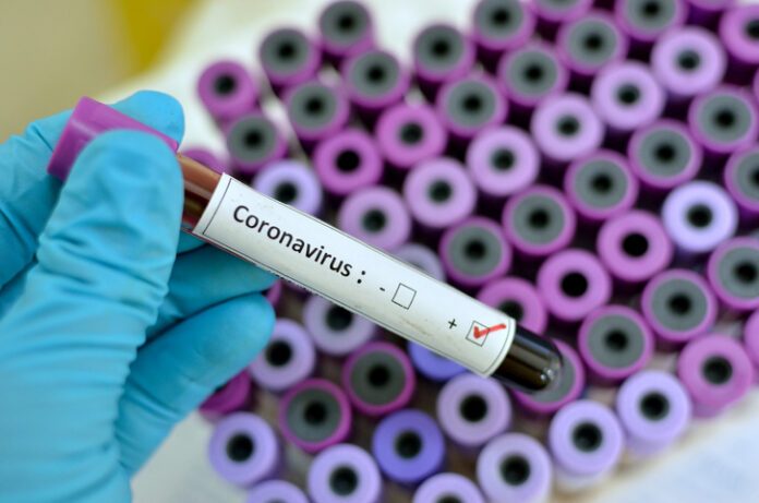 COVID-19: Coronavirus News Update For Sunday, May 31, 2020